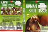  Human Snot Tissue - R17 